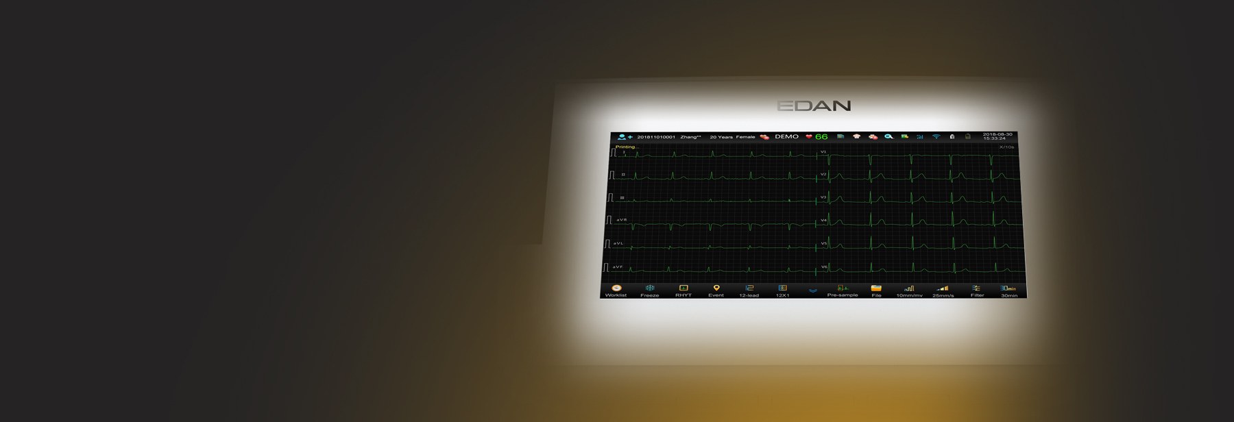 SE-1202 touch UI