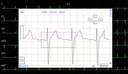 SE-1202 — measurements