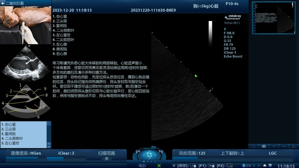 Vetus M11 view 4