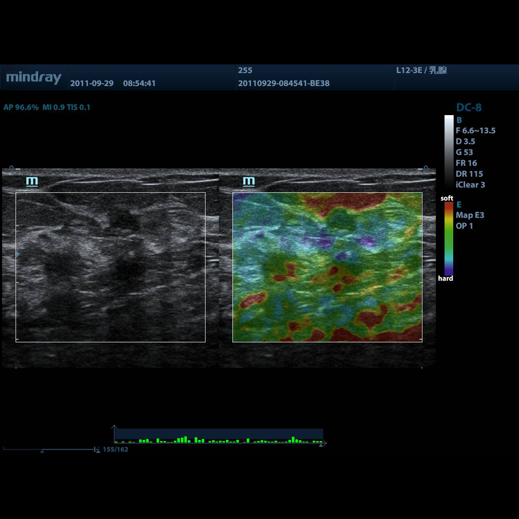 Natural Touch Elastography - Mindray Veterinary Ultrasound Software