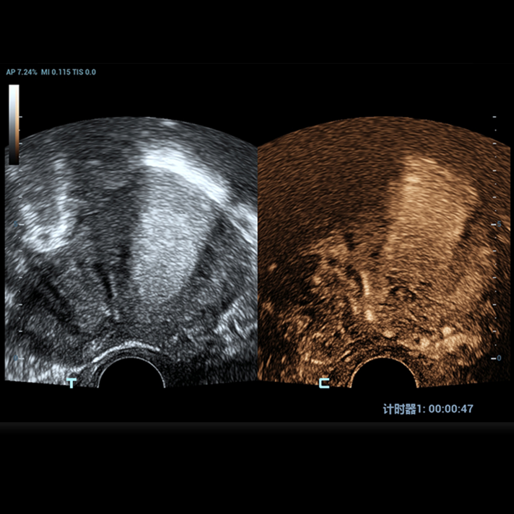 UWN+ Contrast Imaging™ - Mindray Veterinary Ultrasound Software