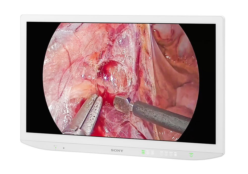 Sony LMD-32M1MD 32" 4K Mini LED surgical monitor