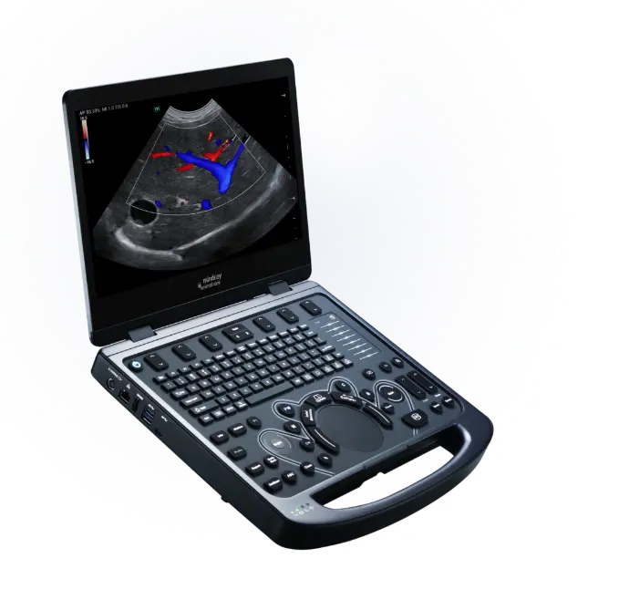 Portable Laptop Ultrasound  VETUS E5 Mindray