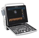Portable Laptop Ultrasound Z60 Mindray