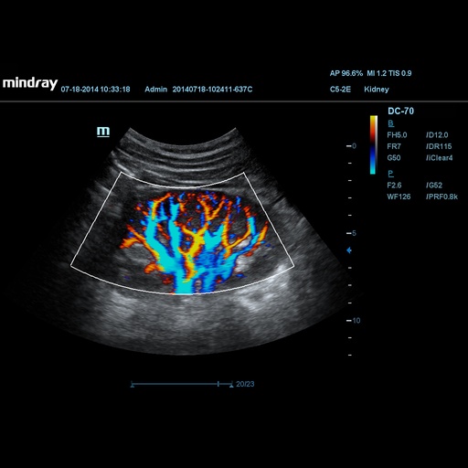[1571500191] HR Flow™ - Mindray Veterinary Ultrasound Software
